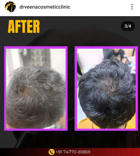 Cover photo of Dr Veena's Cosmetic Clinic - Skin | Hair | Laser | Botox | Filler | Hair Transplantation in Durg